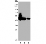 Western blot testing of 1) rat brain, 2) mouse brain and 3) rat C6 lysate with GAP43 antibody. Expected molecular weight ~43 kDa.