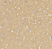 IHC staining of FFPE human brain tissue with GAP43 antibody. HIER: boil tissue sections in pH8 EDTA for 20 min and allow to cool before testing.