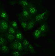 Immunofluorescent staining of FFPE human A431 cells with Glypican 5 antibody. HIER: steam section in pH6 citrate buffer for 20 min.