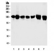 Western blot testing of human 1) placenta, 2) HeLa, 3) A431, 4) A549, 5) K562, 6) rat brain and 7) mouse brain lysate with mGluR1 antibody. Predicted molecular weight ~132 kDa.