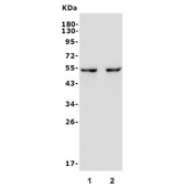 Western blot testing of human 1) SW620 and 2) Jurkat lysate with Gasdermin D antibody. Predicted molecular weight ~53 kDa.