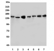 Western blot testing of 1) rat testis, 2) rat liver, 3) mouse testis, 4) mouse liver, 5) mouse RAW236.7, 6) human ThP-1 and 7) human HL-60 lysate with HDAC9 antibody. Expected molecular weight ~150 kDa.