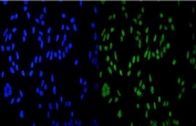 Immunofluorescent staining of FFPE human HeLa cells with HDAC9 antibody (green) and DAPI nuclear stain (blue). HIER: steam section in pH6 citrate buffer for 20 min.