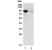 Western blot testing of 1) human A549 and 2) mouse ANA-1 lysate with ITGB5 antibody. Expected molecular weight: 88-110 kDa depending on glycosylation level.