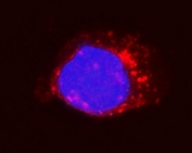 Immunofluorescent staining of FFPE human A431 cells with ITGB5 antibody (red) and DAPI nuclear stain (blue). HIER: steam section in pH6 citrate buffer for 20 min.