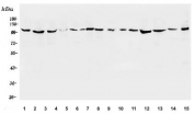 Western blot testing of human 1) placenta, 2) U-87 MG, 3) A549, 4) U937, 5) HL-60, 6) A431, 7) HeLa, 8) rat testis, 9) rat thymus, 10) rat spleen, 11) rat heart, 12) mouse testis, 13) mouse thymus, 14) mouse heart and 15) mouse RAW264.7 lysate with ApoER2 antibody. Predicted molecular weight ~106 kDa.