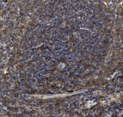 IHC staining of FFPE mouse spleen with Ly6c antibody. HIER: boil tissue sections in pH8 EDTA for 20 min and allow to cool before testing.