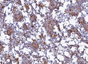 IHC staining of FFPE rat lymph tissue with MCM6 antibody. HIER: boil tissue sections in pH8 EDTA for 20 min and allow to cool before testing.