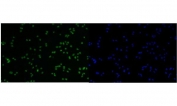 Immunofluorescent staining of FFPE human Caco-2 cells with MCM6 antibody (green) and DAPI nuclear stain (blue). HIER: steam section in pH6 citrate buffer for 20 min.