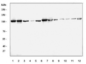 Western blot testing of 1) human HeLa, 2) human Jurkat, 3) human 293T, 4) human A431, 5) human HepG2, 6) human MOLT4, 7) human HL60, 8) rat testis, 9) rat ovary, 10) rat thymus, 11) mouse testis and 12) mouse thymus lysate with MCM6 antibody. Expected molecular weight: 92-105 kDa.