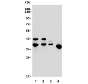 Western blot testing of 1) rat brain, 2) mouse brain, 3) human SH-SY5Y and 4) rat C6 lysate with MLC1 antibody. Molecular weight: commonly observed at ~32-41 kDa / 70-72 kDa / 115kDa (monomer/dimer/trimer).