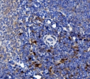 IHC staining of FFPE rat spleen with NCF2 antibody. HIER: boil tissue sections in pH8 EDTA for 20 min and allow to cool before testing.