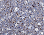 IHC staining of FFPE human tonsil with NCF2 antibody. HIER: boil tissue sections in pH8 EDTA for 20 min and allow to cool before testing.