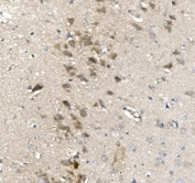 IHC staining of FFPE rat brain with Nectin 1 antibody. HIER: boil tissue sections in pH8 EDTA for 20 min and allow to cool before testing.