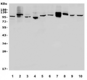 Western blot testing of human 1) HEK293, 2) CCRF-CEM, 3) SW620, 4) U-87 MG, 5) SGC-7901, 6) Jurkat, 7) rat PC-12, 8) mouse spleen, 9) mouse NIH 3T3 and 10) mouse RAW264.7 lysate with Nectin 1 antibody. Predicted molecular weight ~110 kDa.