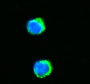 Immunofluorescent staining of FFPE human SiHa cells with NNT antibody (green) and DAPI nuclear stain (blue). HIER: steam section in pH6 citrate buffer for 20 min.