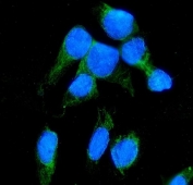 Immunofluorescent staining of FFPE human U-2 OS cells with NNT antibody (green) and DAPI nuclear stain (blue). HIER: steam section in pH6 citrate buffer for 20 min.