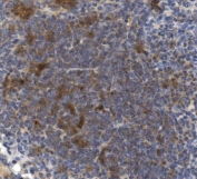 IHC staining of FFPE mouse spleen with Cd73 antibody. HIER: boil tissue sections in pH8 EDTA for 20 min and allow to cool before testing.