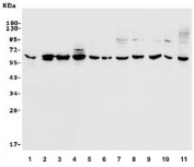 Western blot testing of human 1) placenta, 2) SW579, 3) A431, 4) U-2 OS, 5) rat thymus, 6) rat ovary, 7) rat lung, 8) mouse thymus, 9) mouse ovary, 10) mouse lung and 11) mouse SP2/0 lysate with PAX1 antibody. Expected molecular weight: 45-55 kDa.
