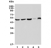 Western blot testing of 1) human SH-SY5Y, 2) human K562, 3) human SW620, 4) rat brain and 5) mouse NIH 3T3 lysate with PAX3 antibody. Expected molecular weight: 22-56 kDa (multiple isoforms).