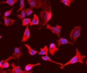 Immunofluorescent staining of FFPE human HeLa cells with PEPC antibody (red) and DAPI nuclear stain (blue). HIER: steam section in pH6 citrate buffer for 20 min.