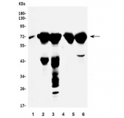 Western blot testing of 1) human HepG2, 2) rat liver, 3) rat kidney, 4) mouse liver and 5) mouse kidney lysate with PEPC antibody. Predicted molecular weight: ~69 kDa.
