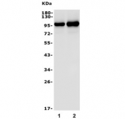 Western blot testing of 1) rat eye and 2) mouse eye tissue with PDE6 alpha antibody. Predicted molecular weight ~100 kDa.