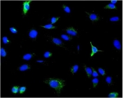 Immunofluorescent staining of FFPE human A549 cells with PDE6 beta antibody (green) and DAPI nuclear stain (blue). HIER: steam section in pH6 citrate buffer for 20 min.