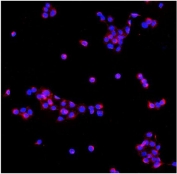 Immunofluorescent staining of FFPE human A431 cells with PDE6 beta antibody (red) and DAPI nuclear stain (blue). HIER: steam section in pH6 citrate buffer for 20 min.