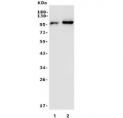 Western blot testing of 1) rat eye and 2) mouse eye tissue with PDE6 beta antibody. Predicted molecular weight ~98 kDa.