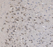 IHC staining of FFPE rat brain with PNPT1 antibody. HIER: boil tissue sections in pH8 EDTA for 20 min and allow to cool before testing.