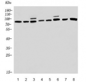 Western blot testing of 1) rat brain, 2) rat kidney, 3) rat C6, 4) mouse brain, 5) mouse kidney, 6) mouse Neuro-2a, 7) human K562 and 8) human ThP-1 lysate with PNPT1 antibody. Predicted molecular weight ~86 kDa.