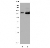 Western blot testing of 1) rat brain and 2) human U-87 MG lysate with PRMT8 antibody. Predicted molecular weight ~45 kDa.