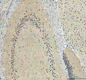 IHC staining of FFPE rat brain with PRMT8 antibody. HIER: boil tissue sections in pH8 EDTA for 20 min and allow to cool before testing.