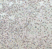 IHC staining of FFPE mouse brain with PRMT8 antibody. HIER: boil tissue sections in pH8 EDTA for 20 min and allow to cool before testing.