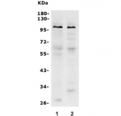 Western blot testing of human 1) placenta and 2) Caco-2 lysate with Prominin 1 antibody. Predicted molecular weight: ~97 kDa (unmodified), ~130 kDa (glycosylated).