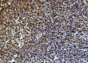 IHC staining of FFPE mouse spleen with Rad9a antibody. HIER: boil tissue sections in pH8 EDTA for 20 min and allow to cool before testing.