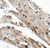 IHC staining of FFPE mouse heart with Rad9a antibody. HIER: boil tissue sections in pH8 EDTA for 20 min and allow to cool before testing.