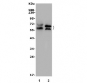 Western blot testing of 1) mouse spleen and 2) rat PC-12 lysate with Rad9a antibody. Expected molecular weight: 45-70 kDa depending on phosphorylation level.