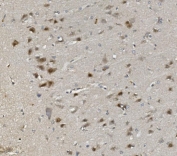 IHC staining of FFPE rat brain with Rad9b antibody. HIER: boil tissue sections in pH8 EDTA for 20 min and allow to cool before testing.