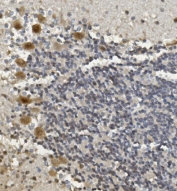 IHC staining of FFPE rat brain with Rad9b antibody. HIER: boil tissue sections in pH8 EDTA for 20 min and allow to cool before testing.
