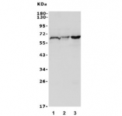 Western blot testing of 1) rat RH35, 2) mouse NIH 3T3 and 3) mouse SP2/0 lysate with Rad9b antibody. Expected molecular weight: 46-60 kDa.