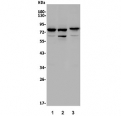 Western blot testing of 1) mouse heart, 2) mouse NIH 3T3 and 3) rat heart lysate with Rad17 antibody. Predicted molecular weight ~77 kDa.