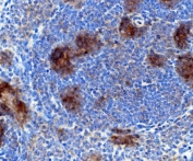 IHC staining of FFPE rat spleen with Rad17 antibody. HIER: boil tissue sections in pH8 EDTA for 20 min and allow to cool before testing.