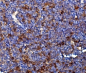 IHC staining of FFPE mouse Peyer's patches with Rad17 antibody. HIER: boil tissue sections in pH8 EDTA for 20 min and allow to cool before testing.