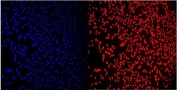 Immunofluorescent staining of FFPE human HeLa cells with RCC1 antibody (red) and DAPI nuclear stain (blue). HIER: steam section in pH6 citrate buffer for 20 min.