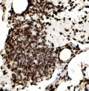 IHC staining of FFPE mouse lung with RCC1 antibody. HIER: boil tissue sections in pH8 EDTA for 20 min and allow to cool before testing.