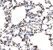 IHC staining of FFPE rat lung with RCC1 antibody. HIER: boil tissue sections in pH8 EDTA for 20 min and allow to cool before testing.