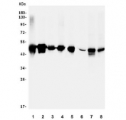 Western blot testing of human 1) HEK293, 2) A431, 3) HepG2, 4) Raji, 5) ThP-1, 6) rat brain, 7) mouse Neuro-2a and 8) mouse NIH 3T3 lysate with RCC1 antibody. Predicted molecular weight ~45 kDa.
