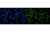 Immunofluorescent staining of FFPE human HeLa cells with RPA32 antibody (green) and DAPI nuclear stain (blue). HIER: steam section in pH6 citrate buffer for 20 min.